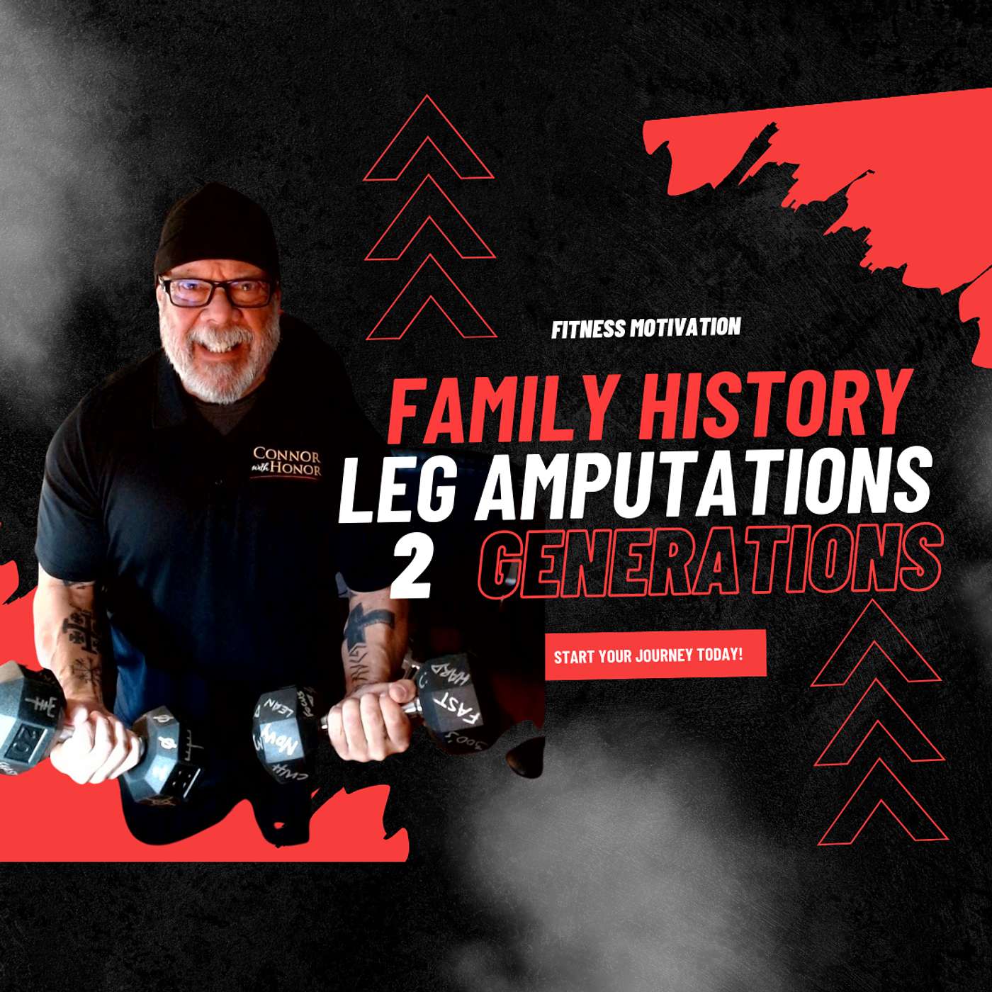 Fat leg amputations for 2 generations it stopped with me as the fat to fit first responder realtor