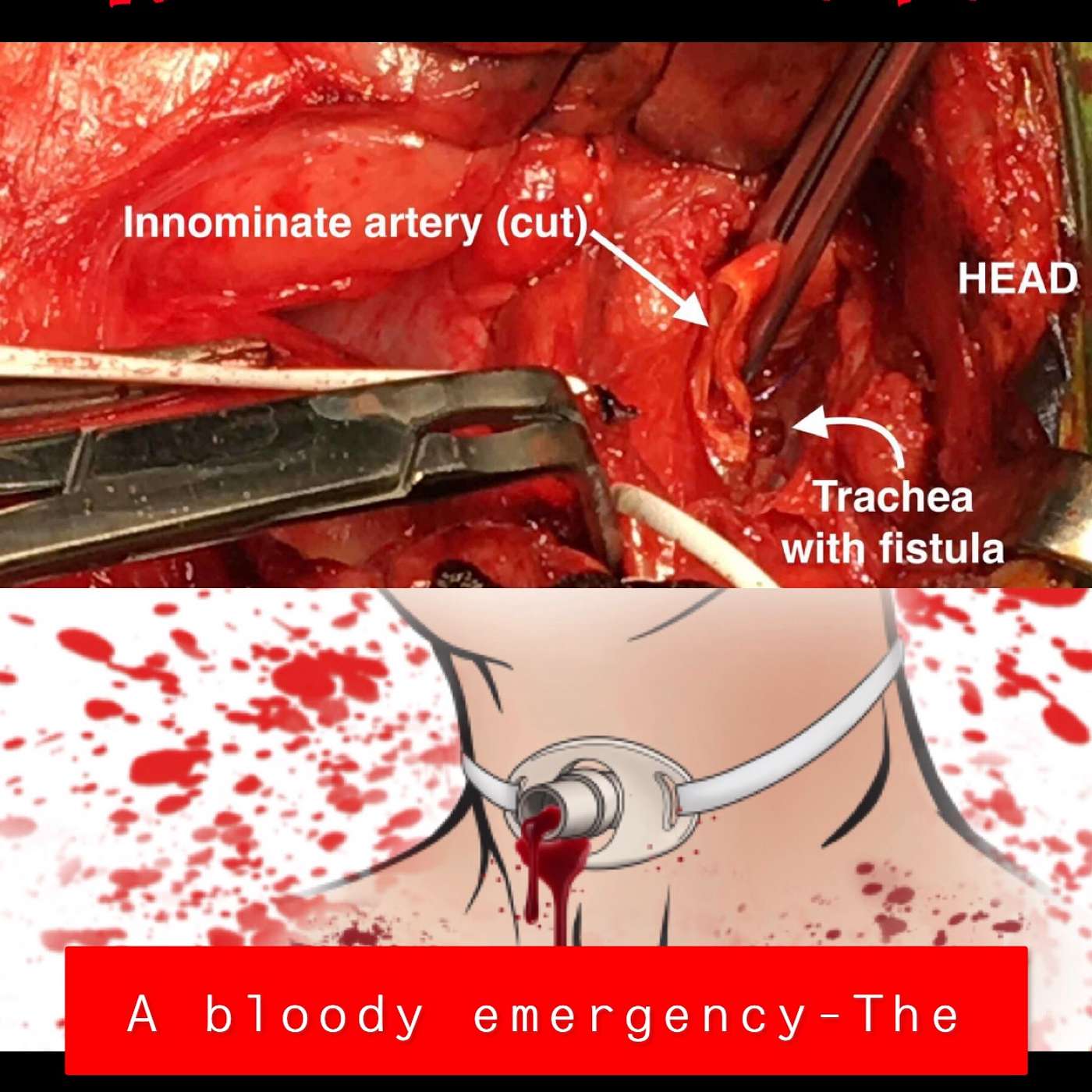 Resus Now