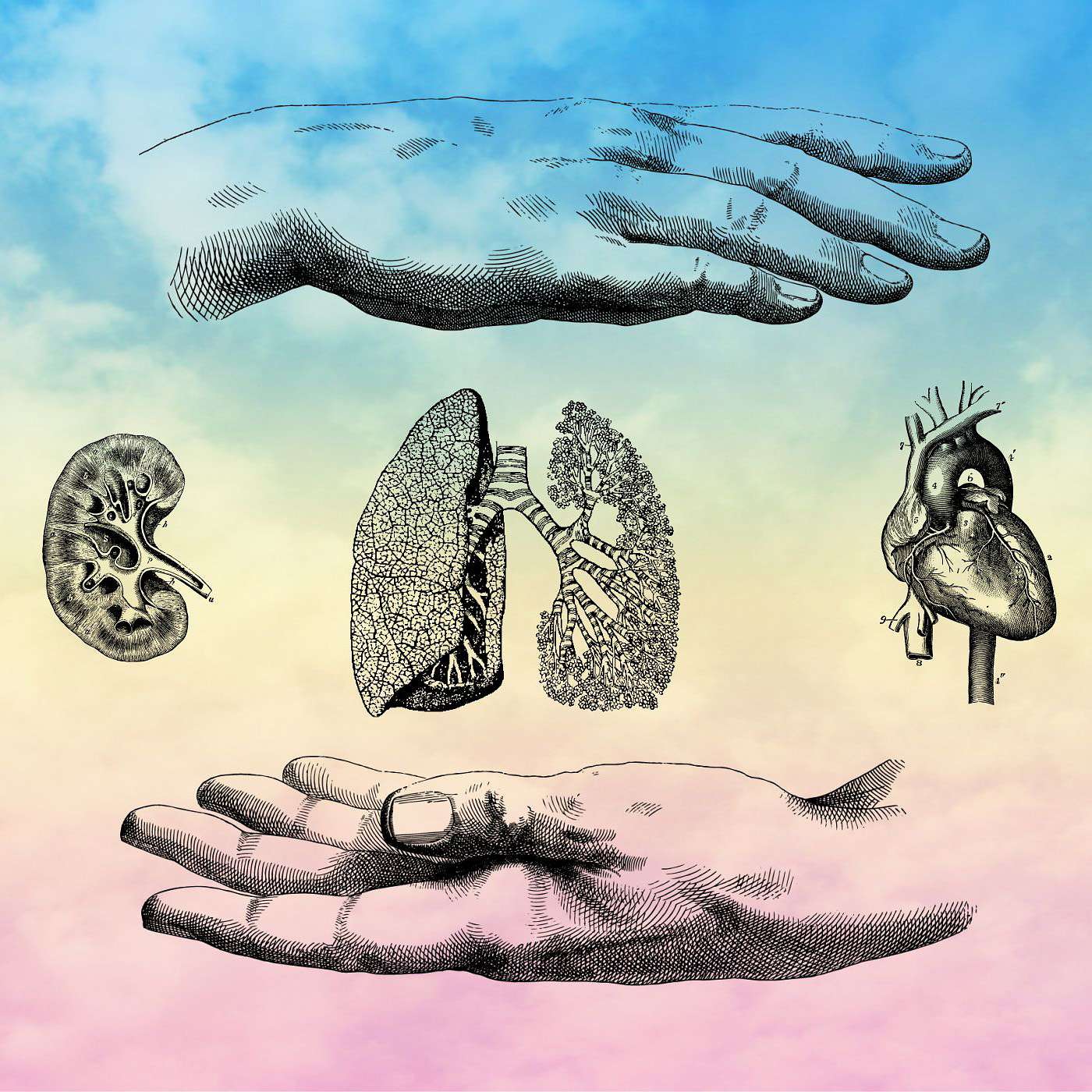 What is Involved in an Organ Transplant?