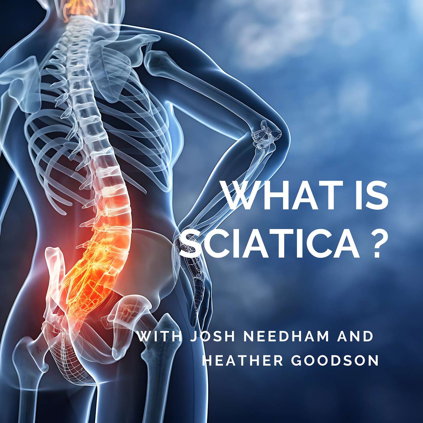 What is sciatica?