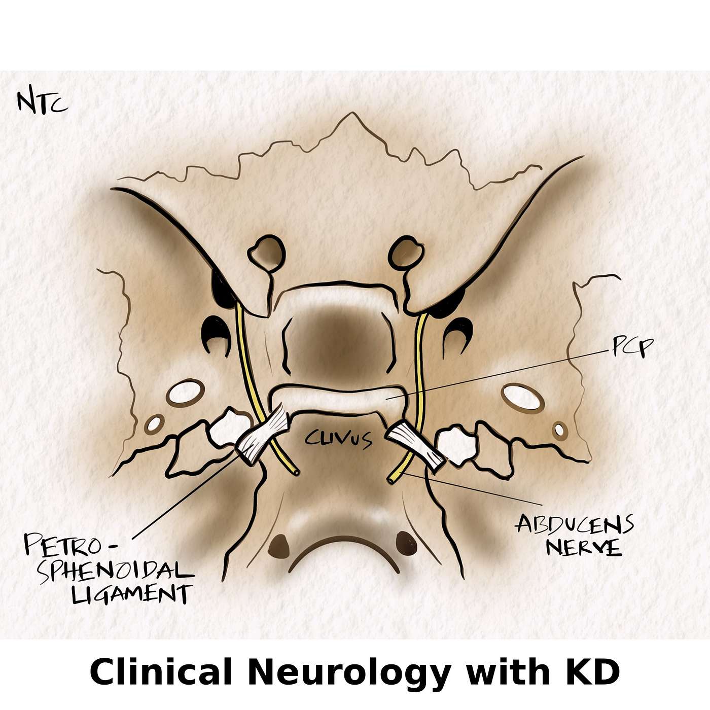 The Abducens nerve conversation