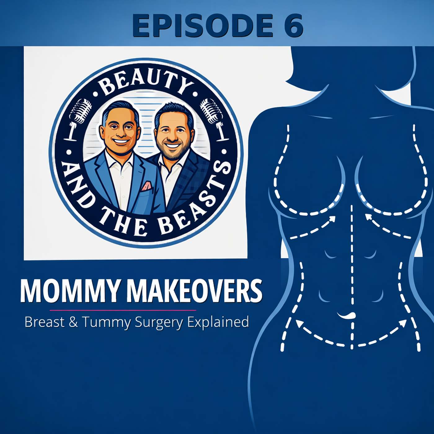 Mommy Makeover What It Is, What It Is Not, and How Surgeons Think About It Mommy Makeover What It Is, What It Is Not, and How Surgeons Think About It