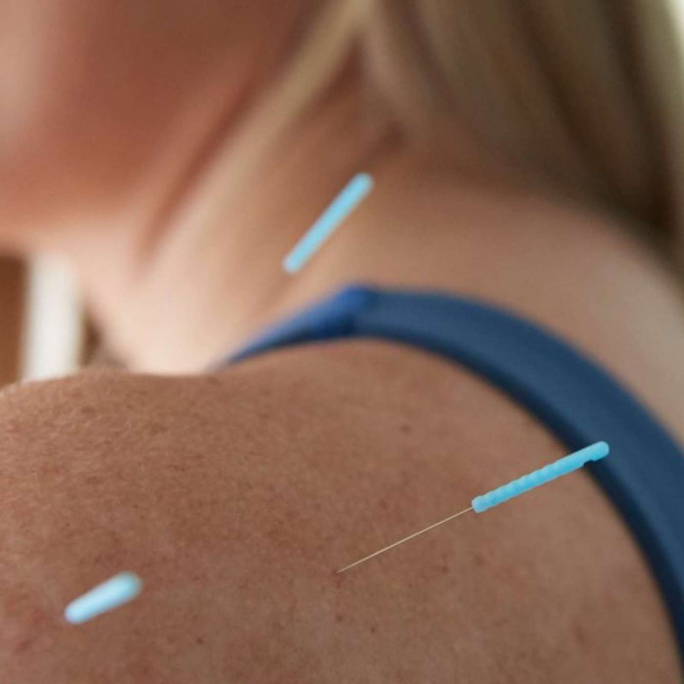Acupuncture for Stress and Anxiety with Vikki Nestico of Grand Wellness
