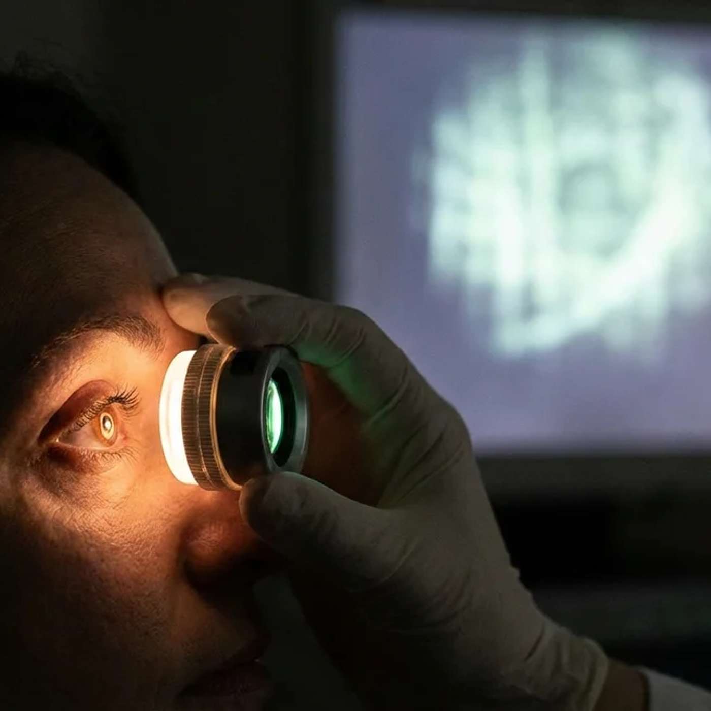 A Treatment That Helped Some Blind Patients See More Light and Shape: What MCO-010 Means for Vision Restoration