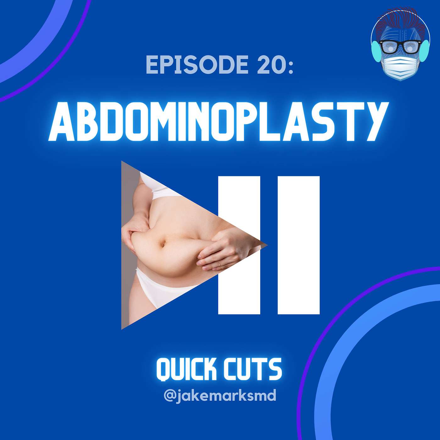 Episode 20: Abdominoplasty