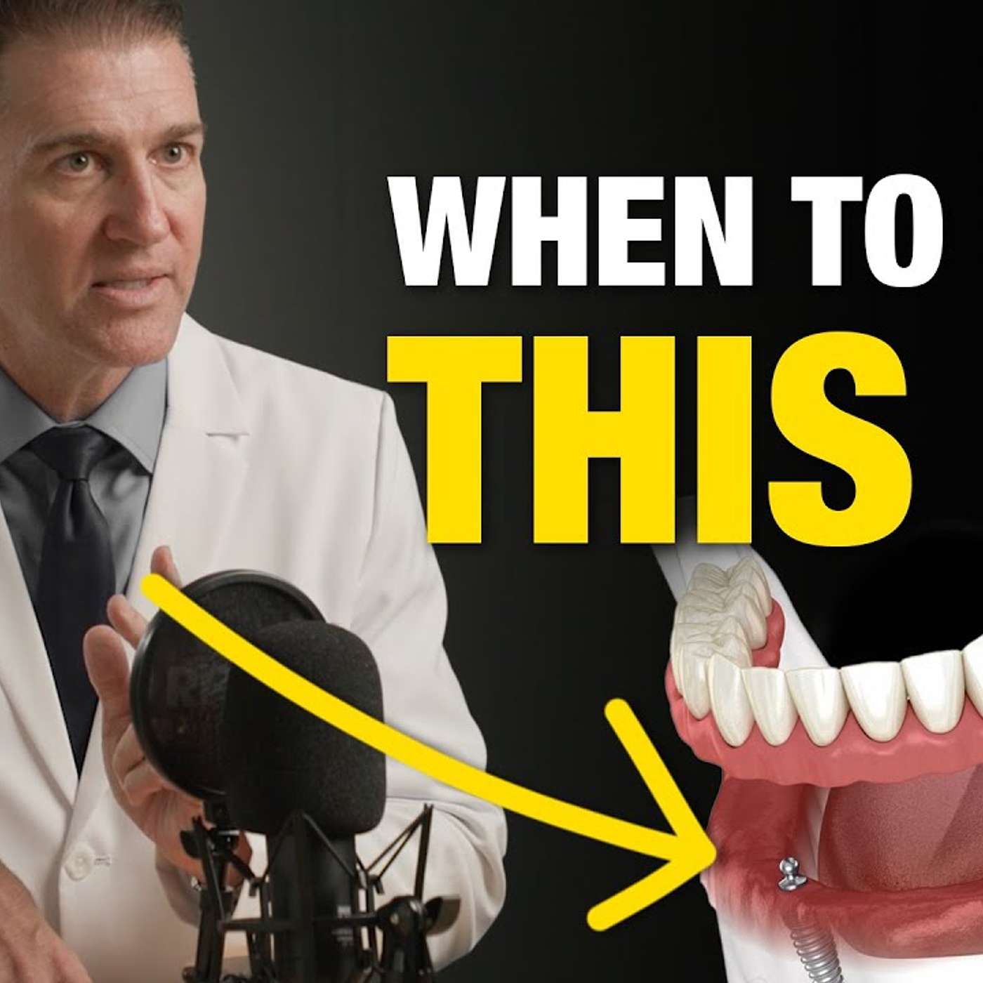 Implants Made Simple