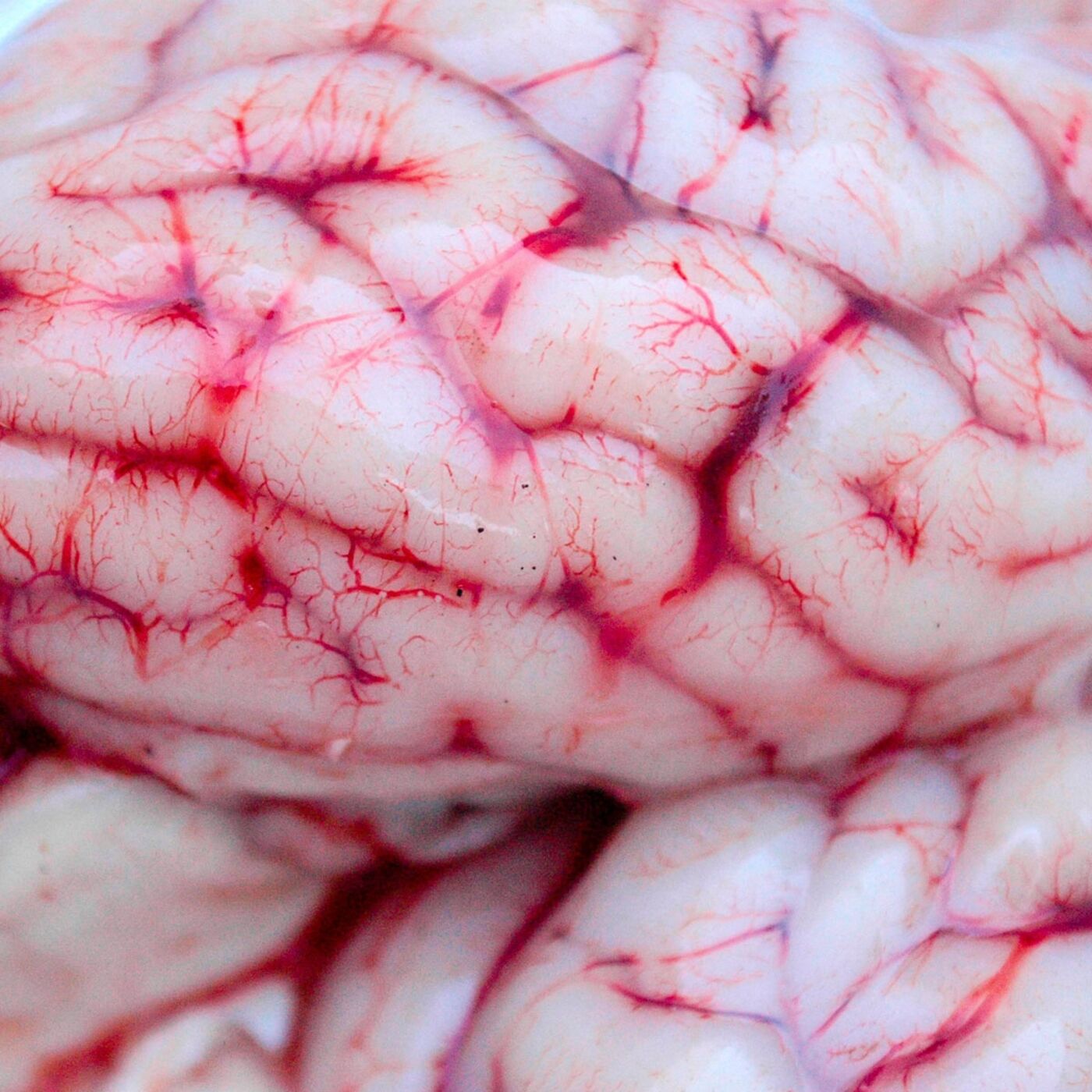 Infections and the Brain