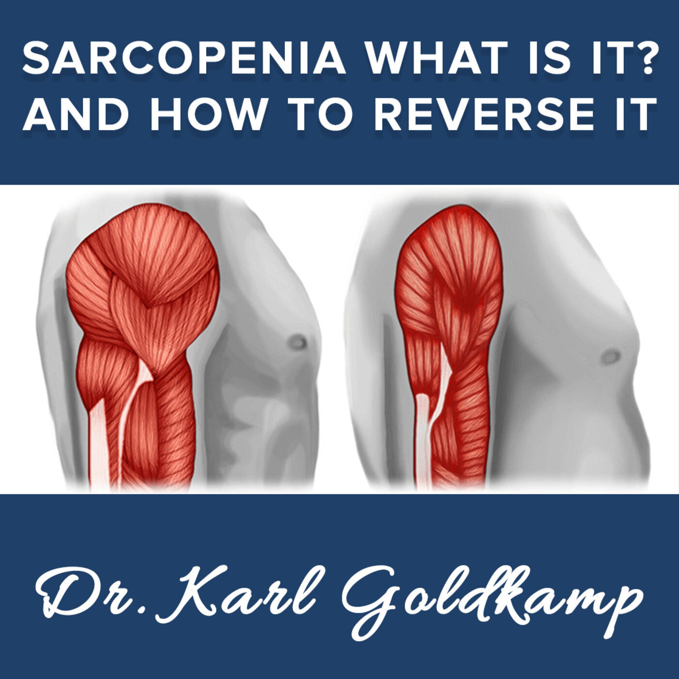 164: Sarcopenia what is it? And how to reverse it? « Keto Naturopath