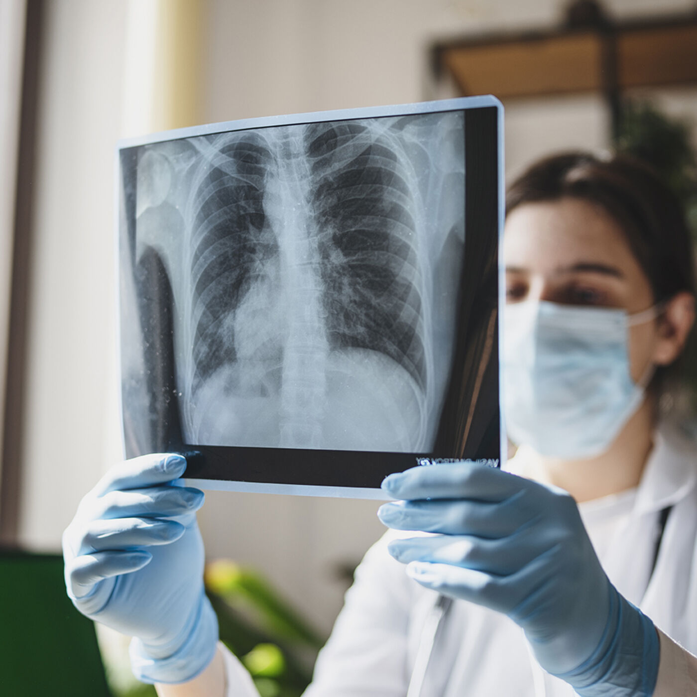 Lungs, Gut, and Skin: Biological Interfaces with the Outside World