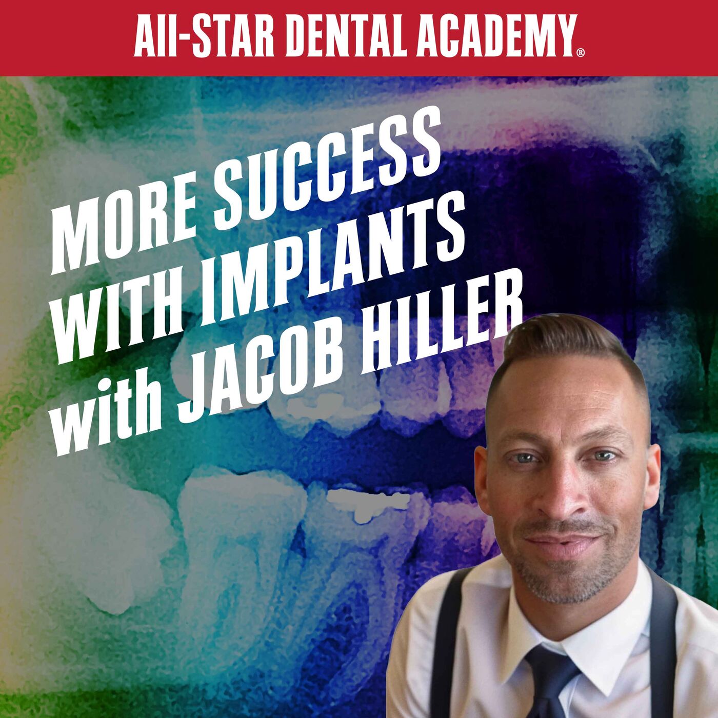 More Success with Implants Dental AllStars Dentistry Business Podcast Podcast Podtail