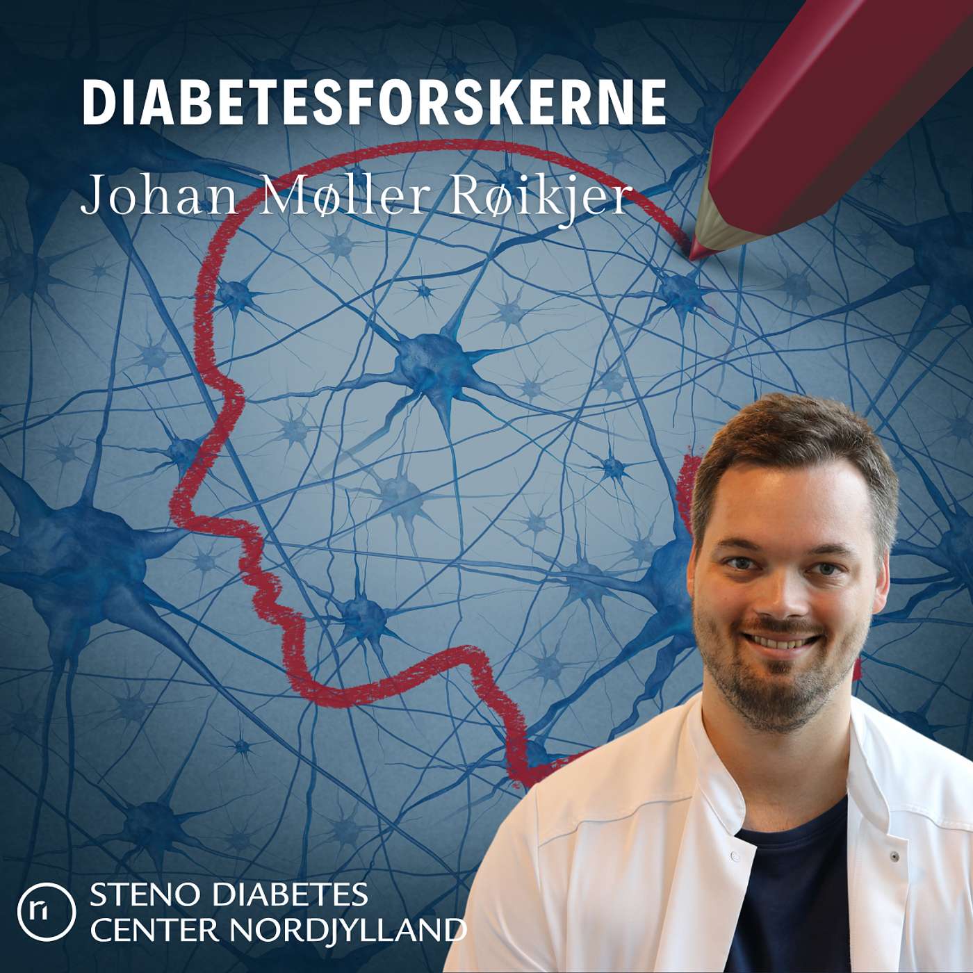 Behandling af nervesmerter skal skræddersyes med kunstig intelligens