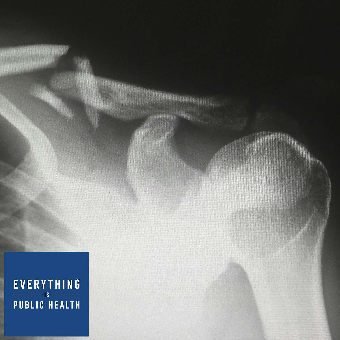 Everything is Public Health