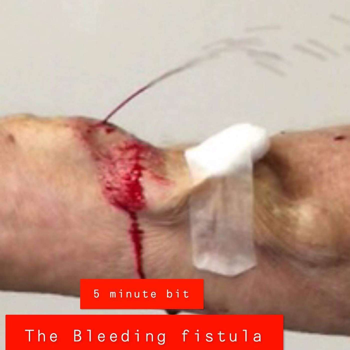 Resus Now