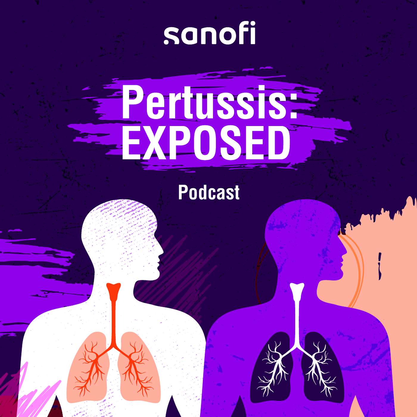 Pertussis: EXPOSED