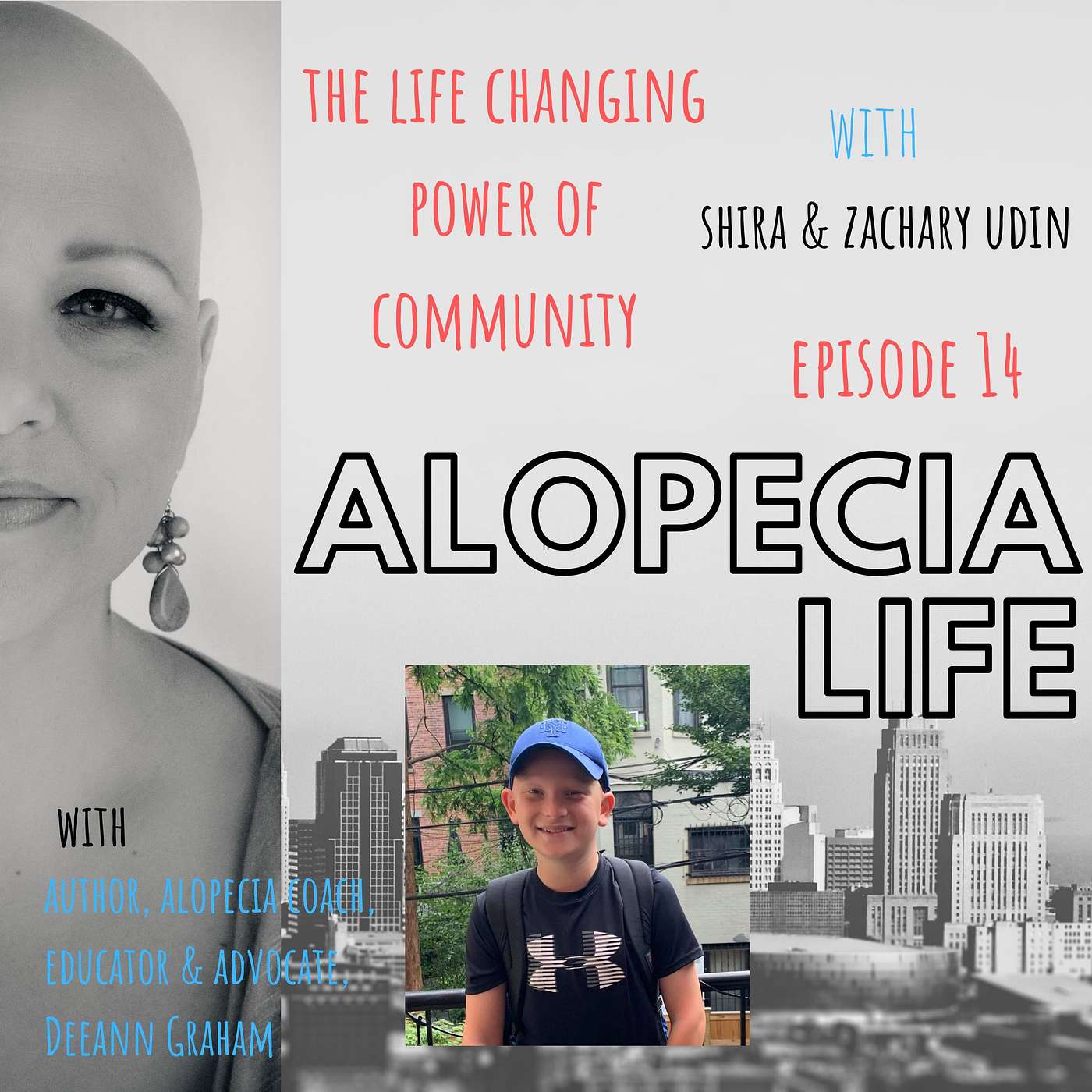 Alopecia Life - E014 The Life Changing Power of Community with Shira & Zachary Udin