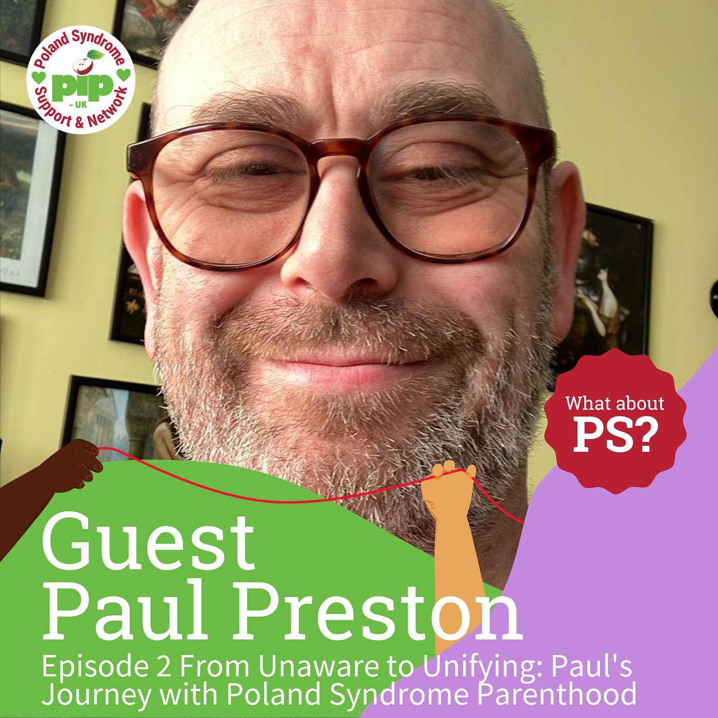 S2E2 From Unaware to Unifying: Paul's Journey with Poland Syndrome Parenthood and PS Fest episode artwork