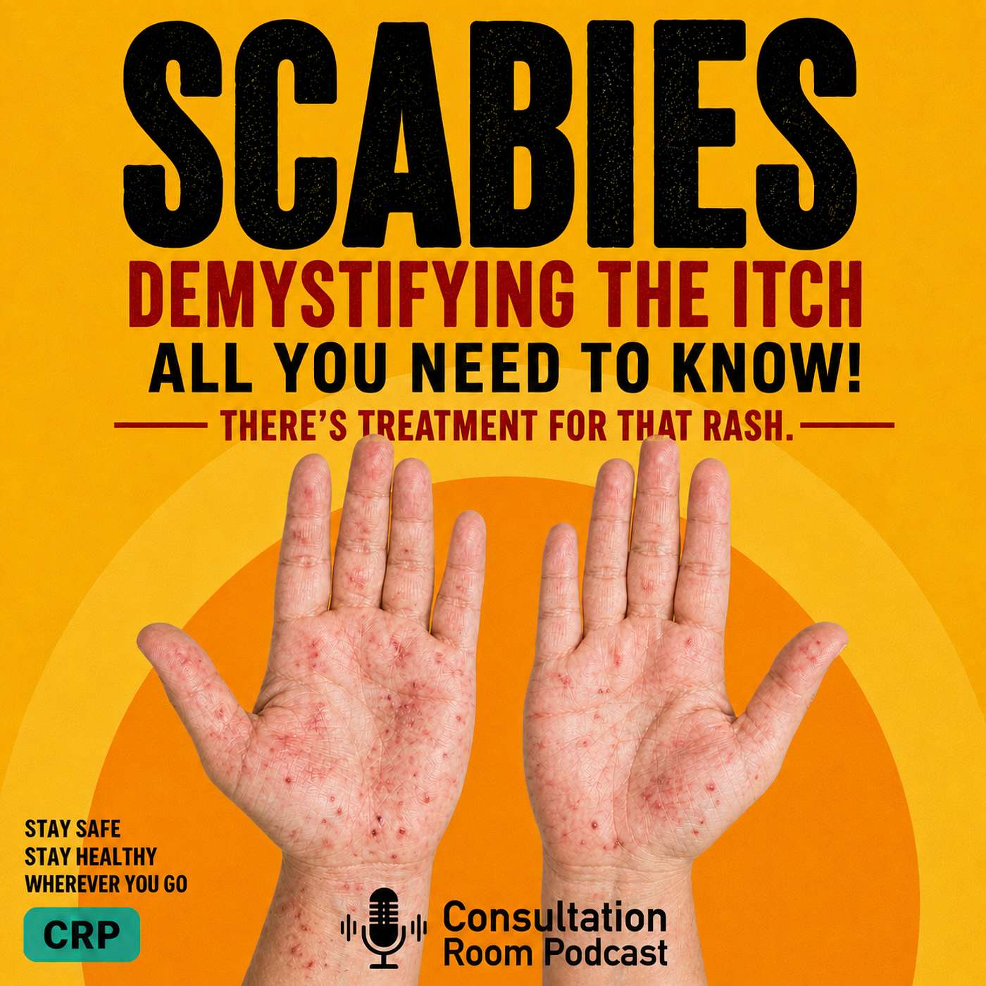 It’s Not Dirt — It’s Scabies! episode artwork