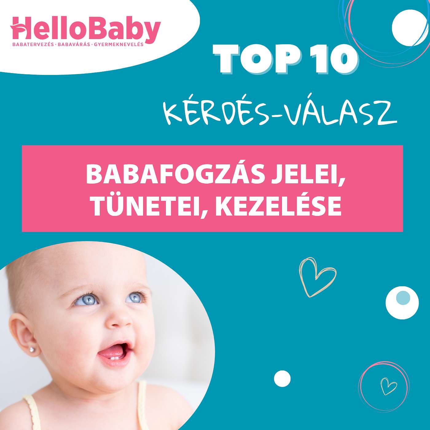 A babafogzás jelei, tünetei, kezelése episode artwork