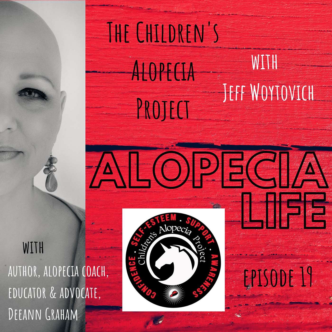 Alopecia Life