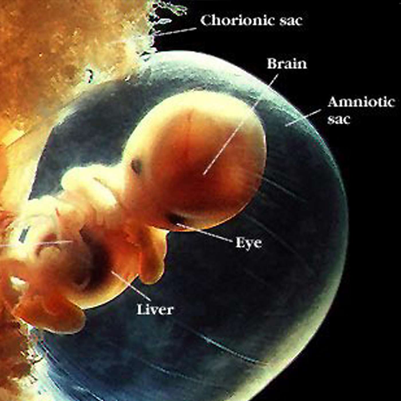 👶🏻The Abortion Solution: Sex, Lies, & Murder #1