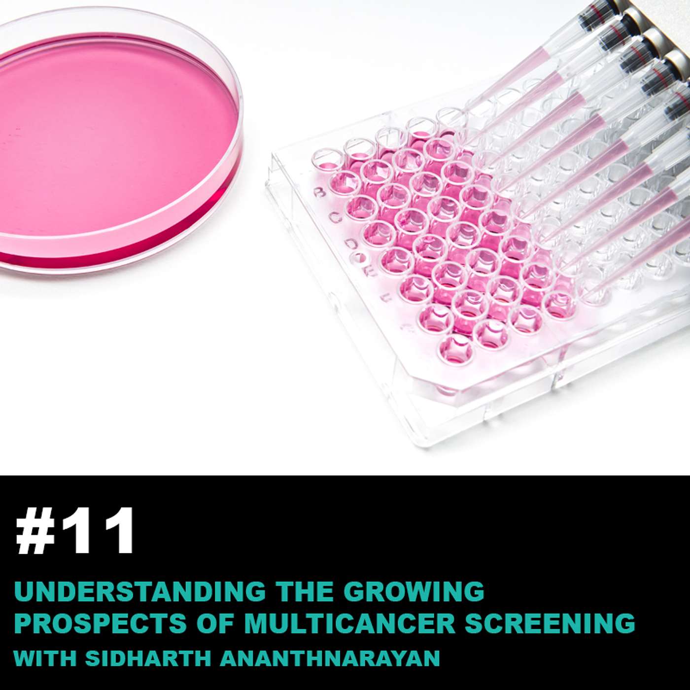 Season2 Ep11: Understanding the Growing Prospects of Multicancer Screening with Sidharth Ananthnarayan episode artwork