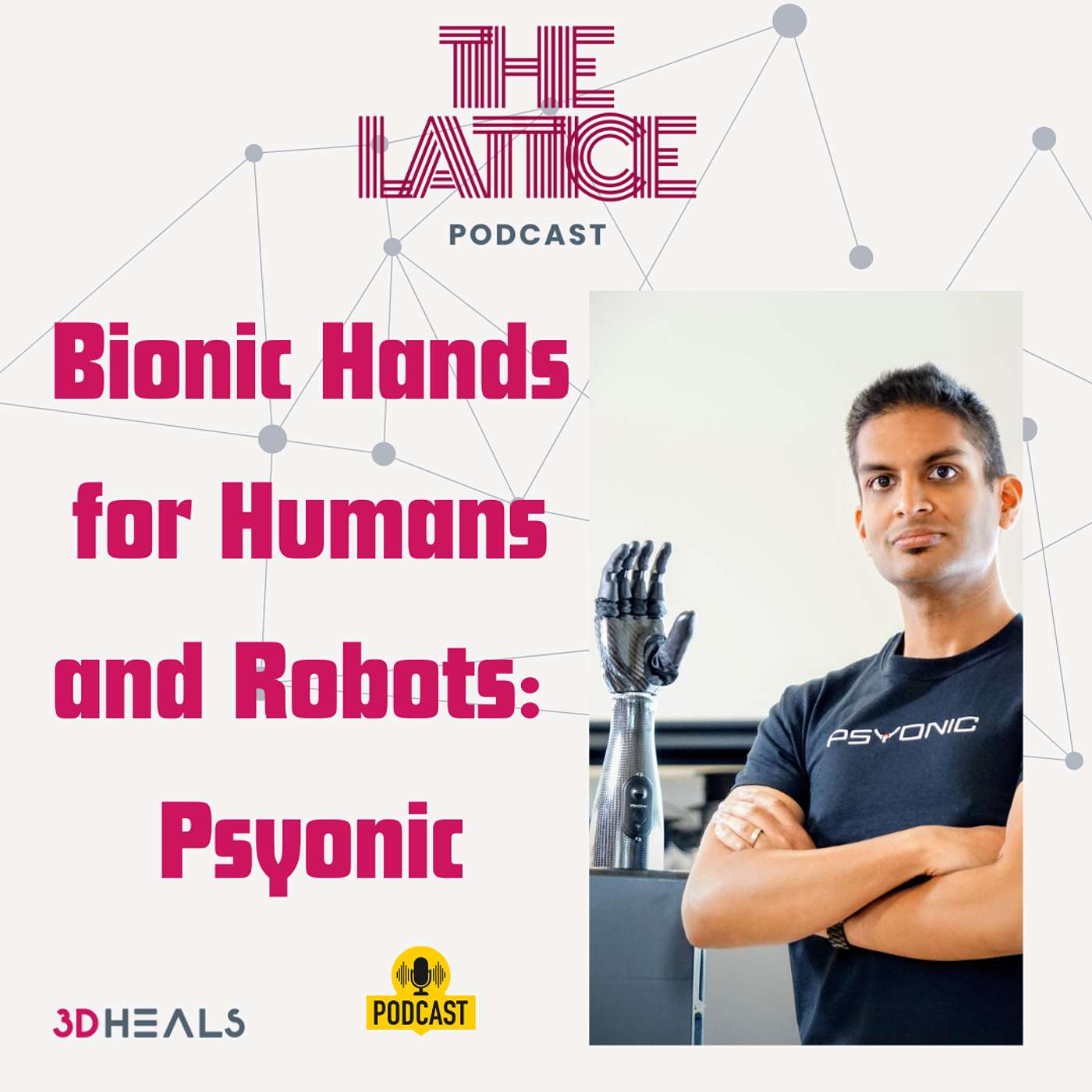 Episode #106| Bionic Hands For Humans and Robots: The Psyonic Story
