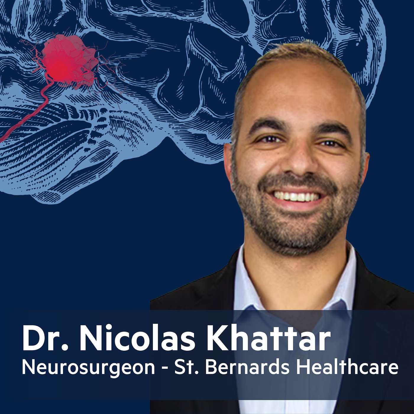 Stress, Ruptures, and Risk Factors: Dr. Khattar Breaks Down Brain Aneurysms