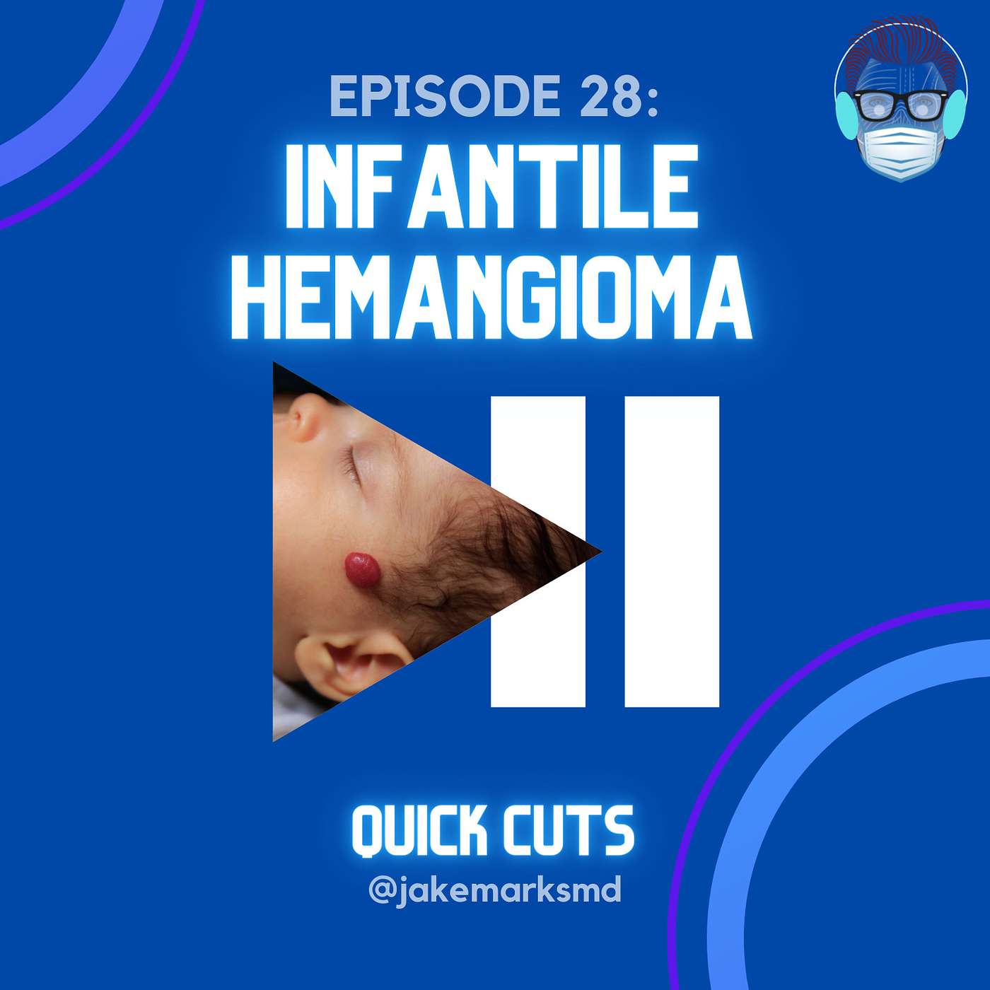 Quick Cuts: A Plastic Surgery Podcast - Episode 28: Infantile Hemangioma