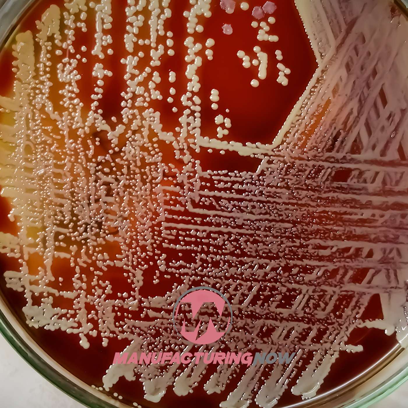 LISTEN: Tyson Loses Flesh-Eating Bacteria Case episode artwork