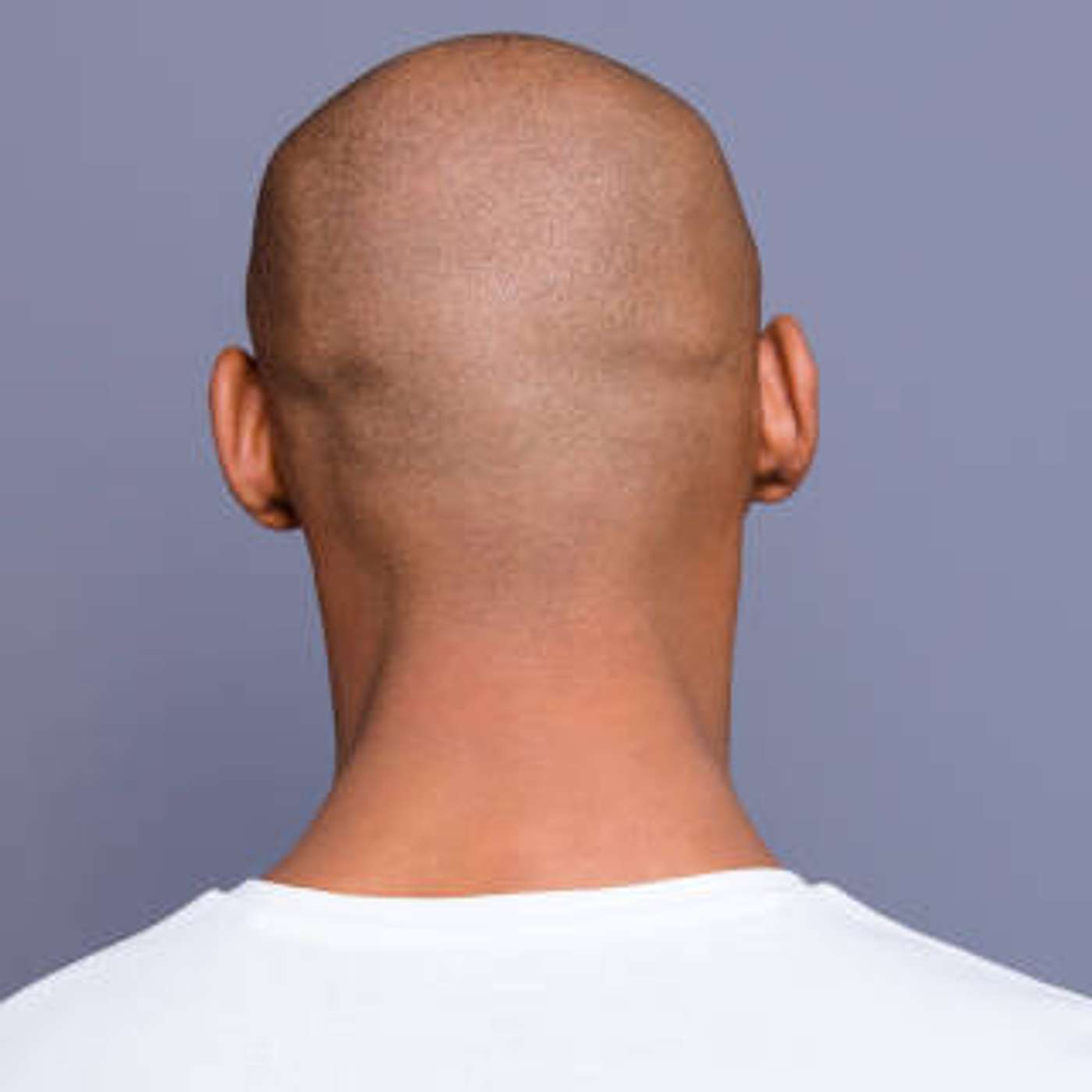 cover of episode Torticollis