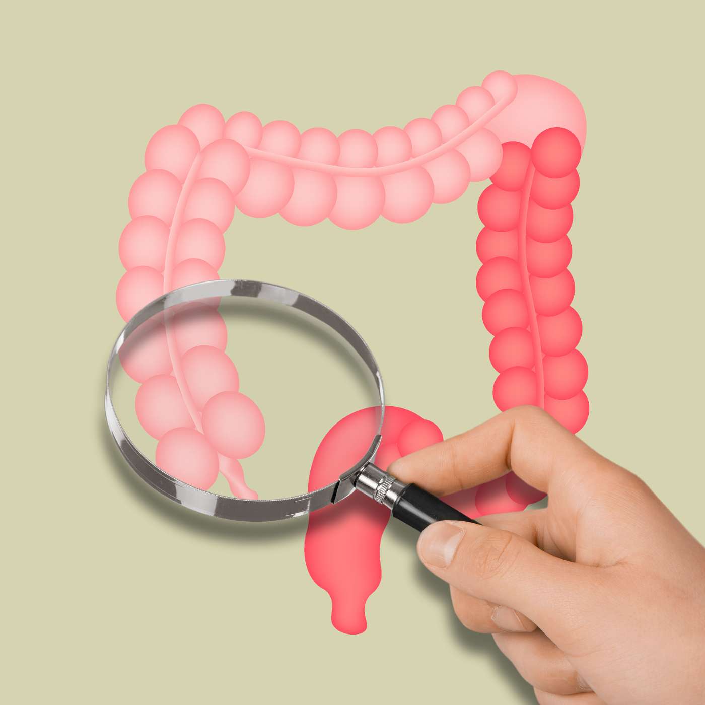 Gut Check: The Lifesaving Power of Colorectal Screening Gut Check: The Lifesaving Power of Colorectal Screening