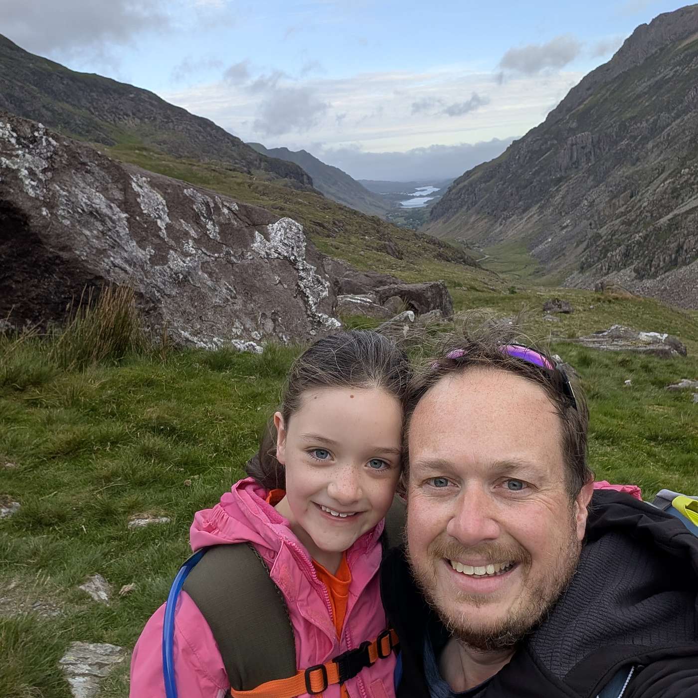 Your Coeliac Stories: Harley’s Climb for Coeliac UK episode artwork