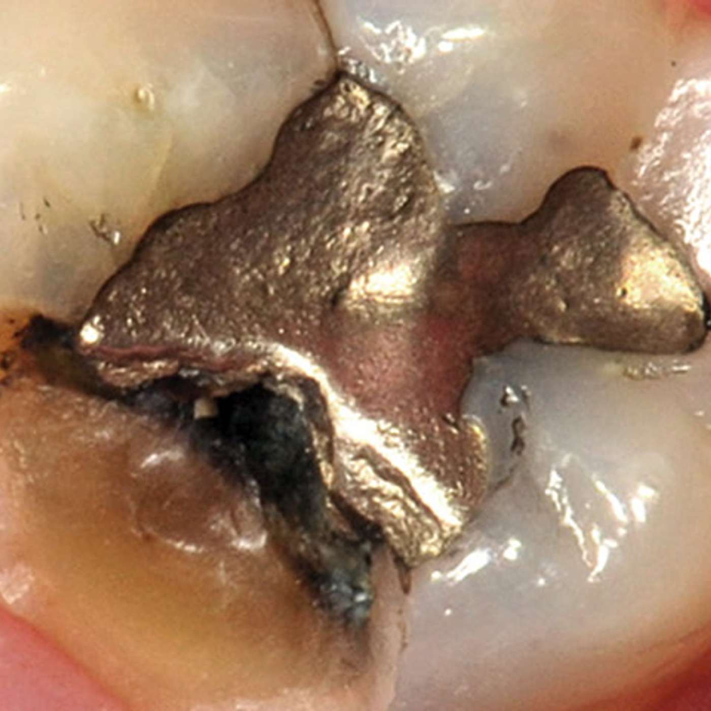 The Dental Practitioner