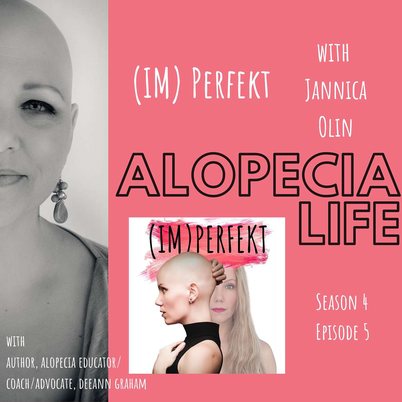 Alopecia Life