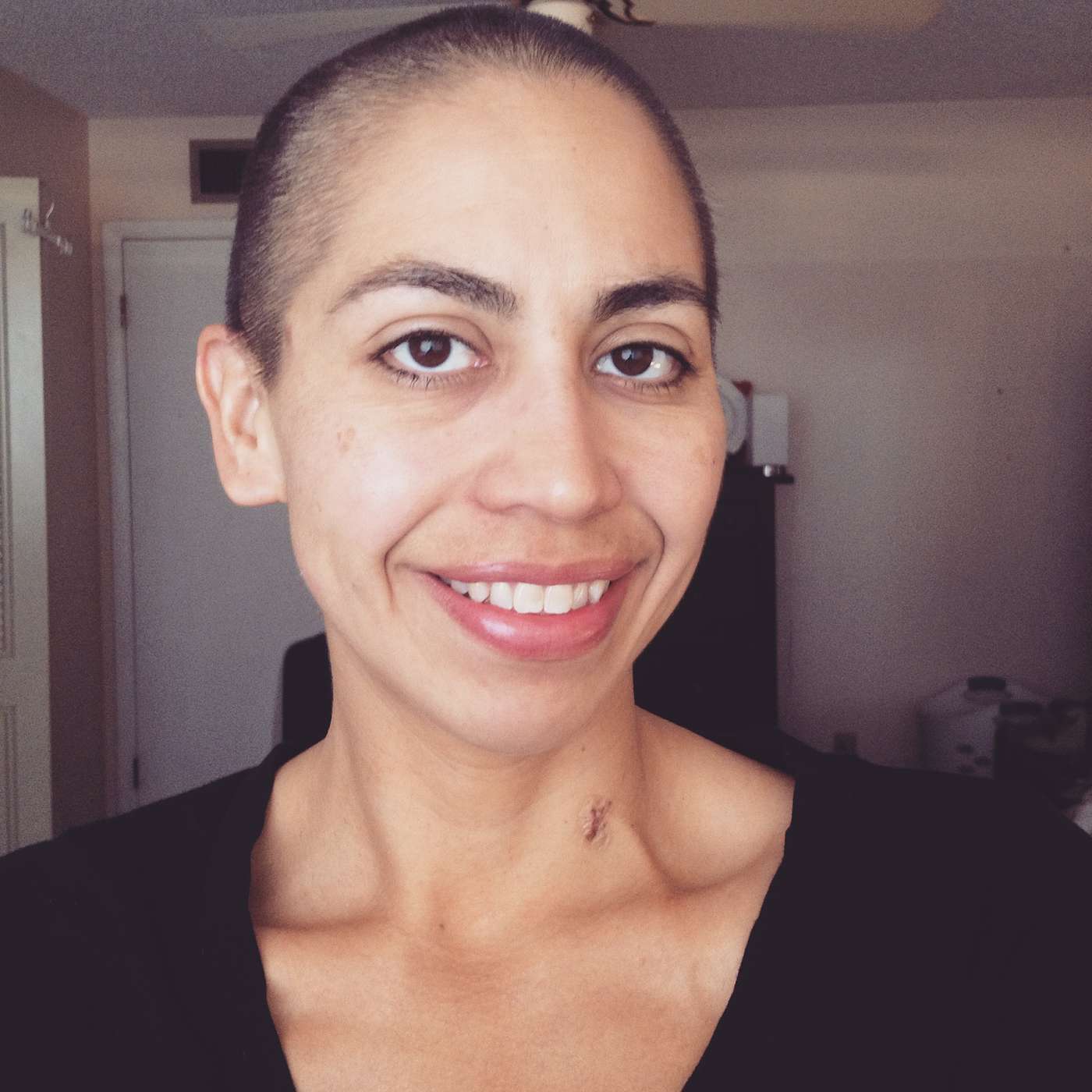 The Bald Project