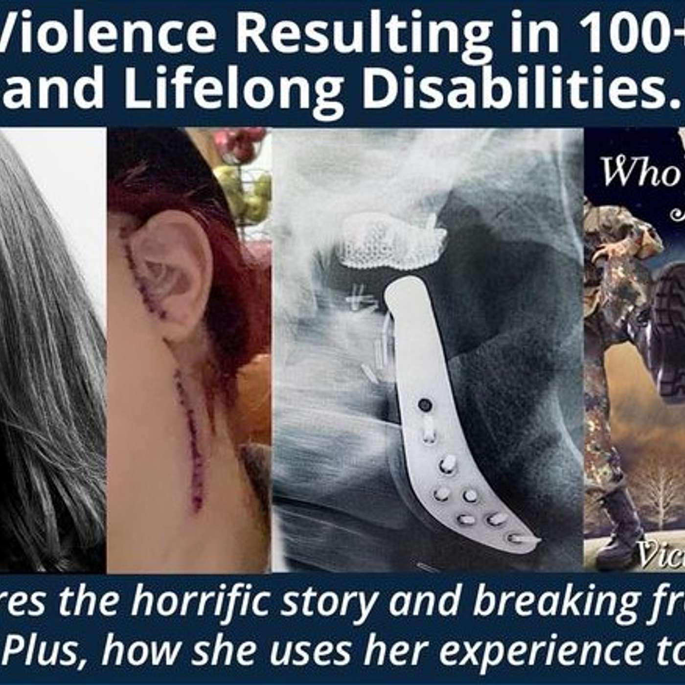 A CONTAGIOUS SMILE'S UNSTOPPABLE GET'S THE INSIDE STORY ON OUR VICTORIA'S SURVIVAL