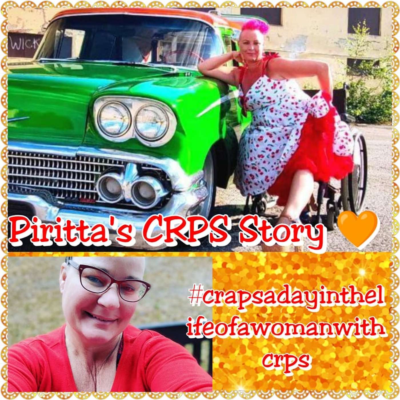 CR(a)PS A Day in a Life with a Woman With CRPS