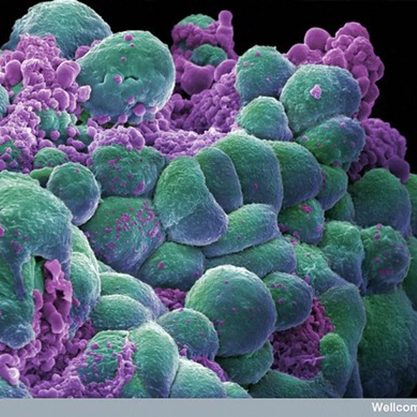 SSD 117 - Le Sénégal construit un centre d’oncologie pouvant traiter tous les cancers episode artwork