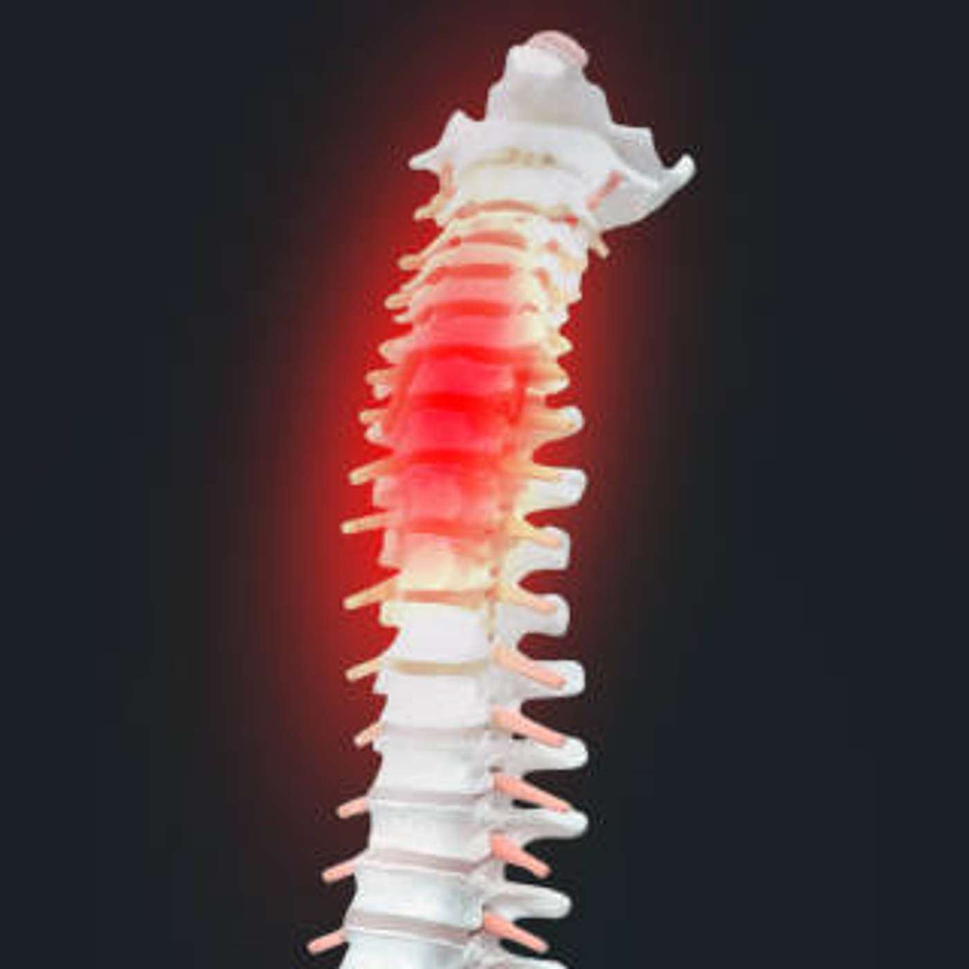 cover of episode Spinal Cord Injury