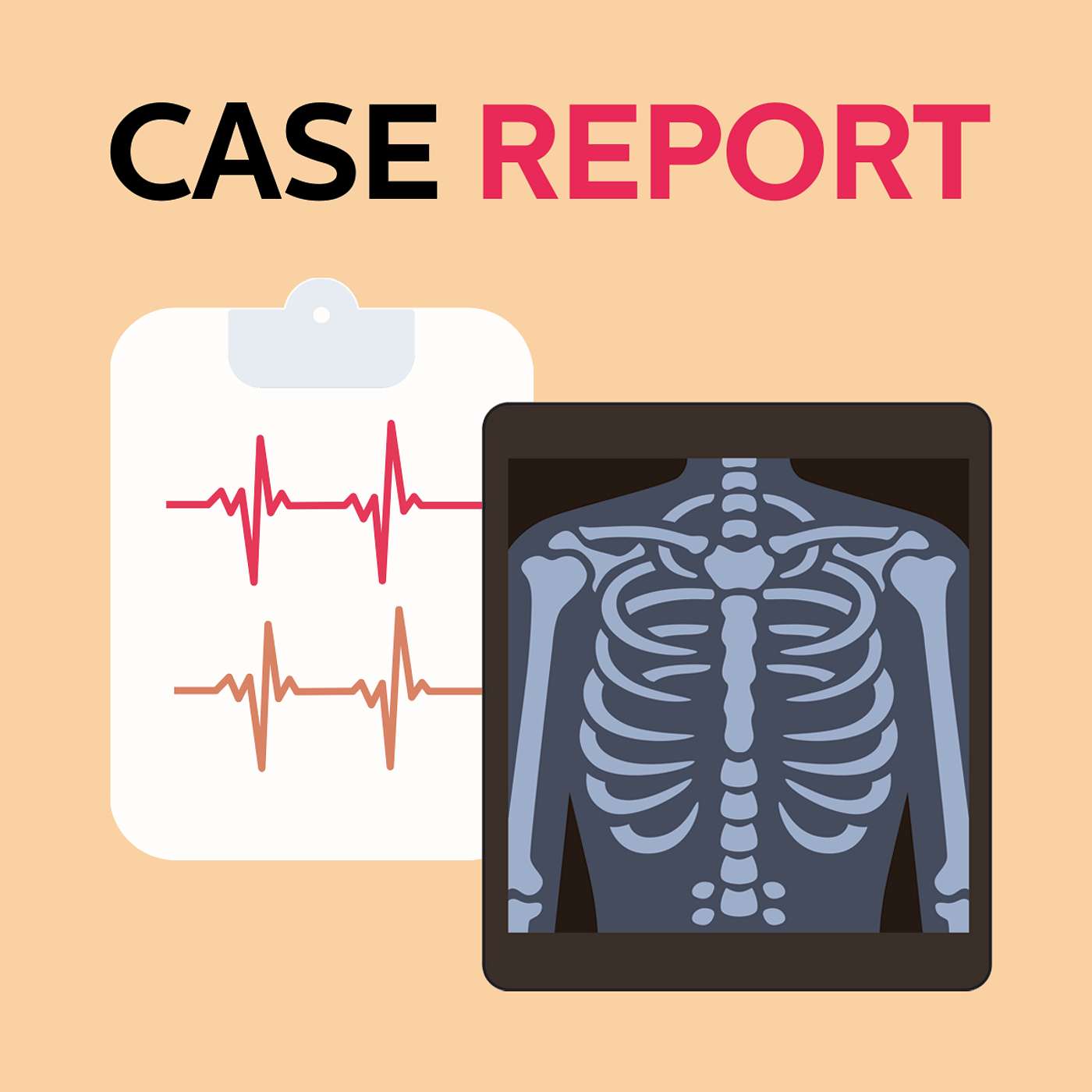 [Case Report] 27yo with left limb weakness and a mediastinal mass