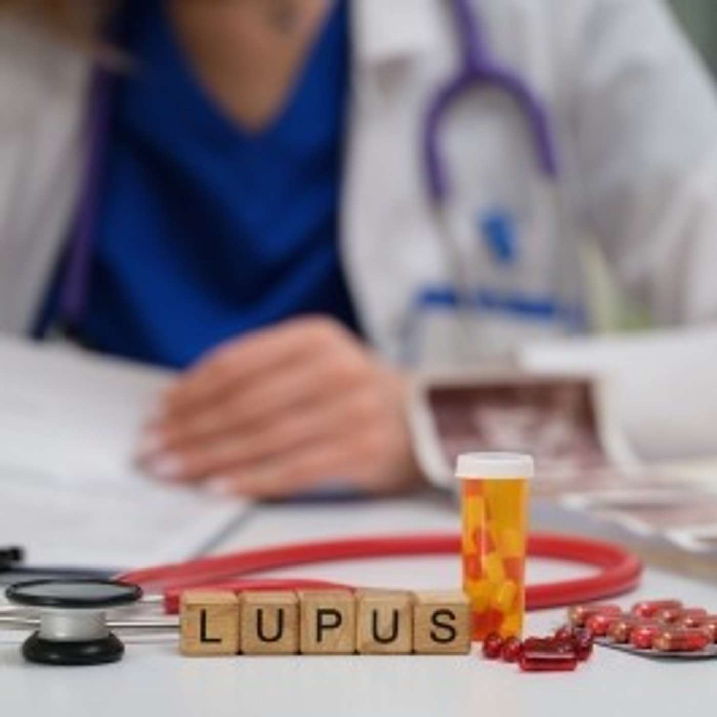 Unraveling Lupus