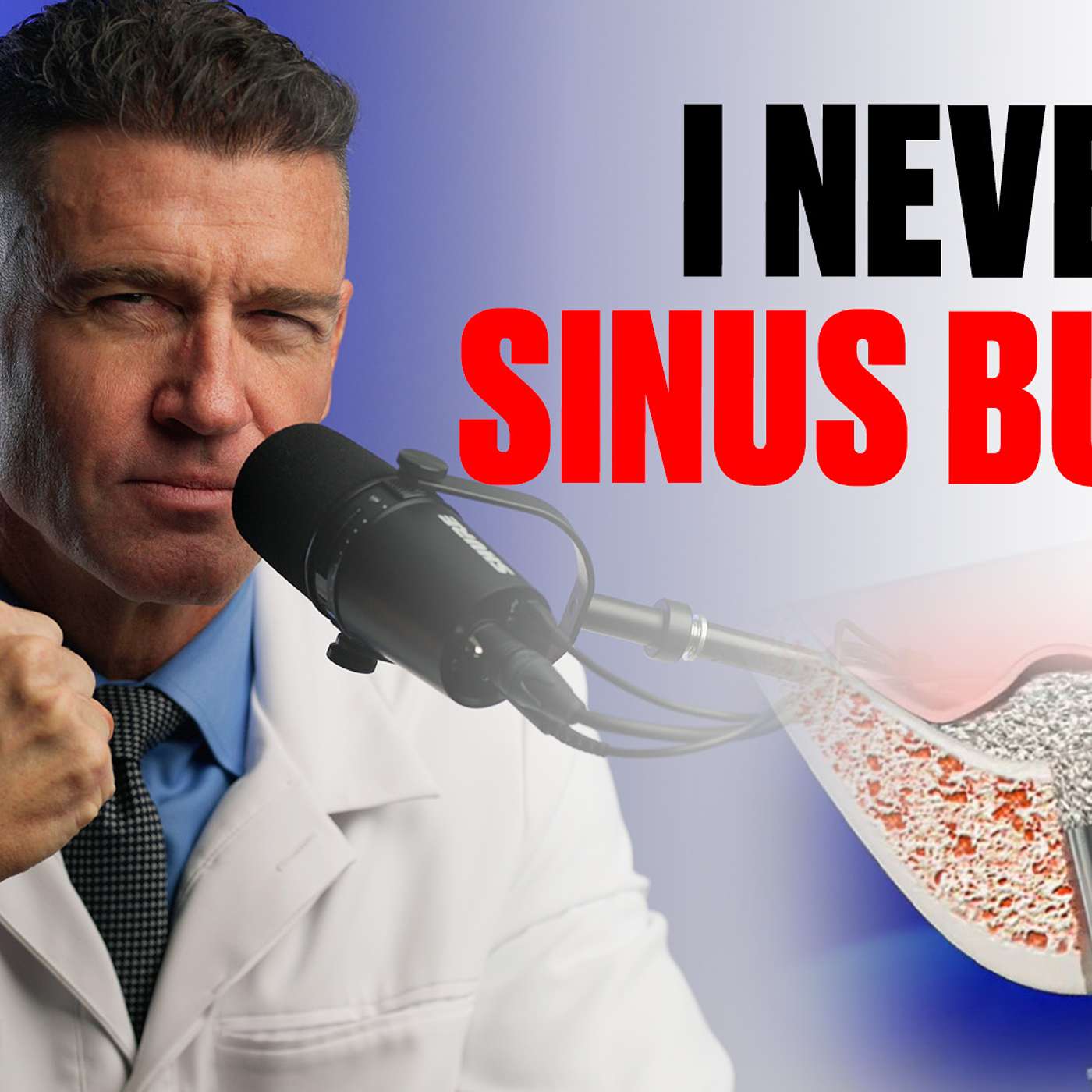 Implants Made Simple