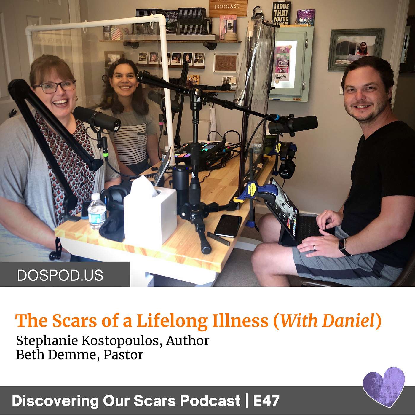 Discovering Our Scars