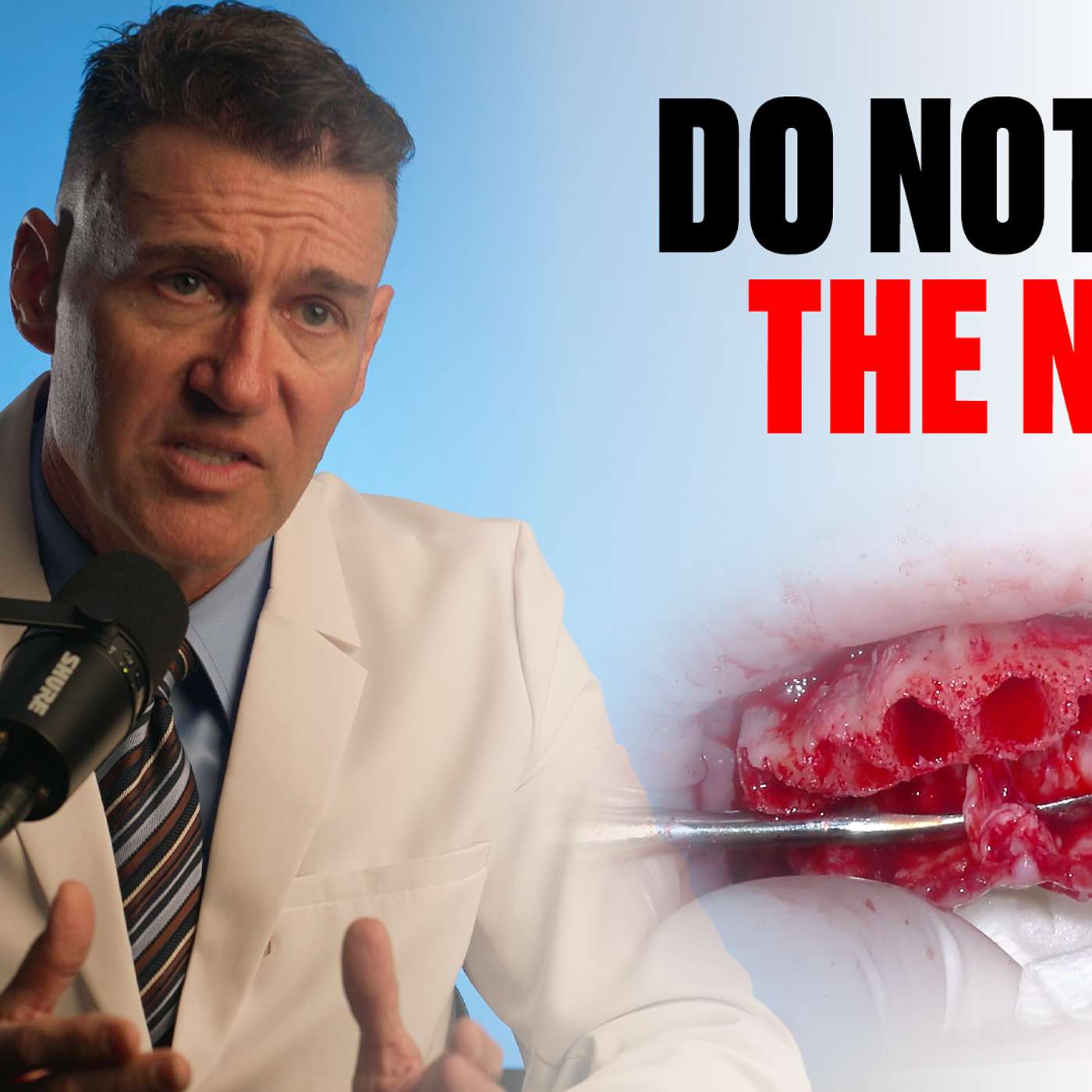 Should You WORRY About the Nasopalatine Nerve in All-on-X? episode artwork