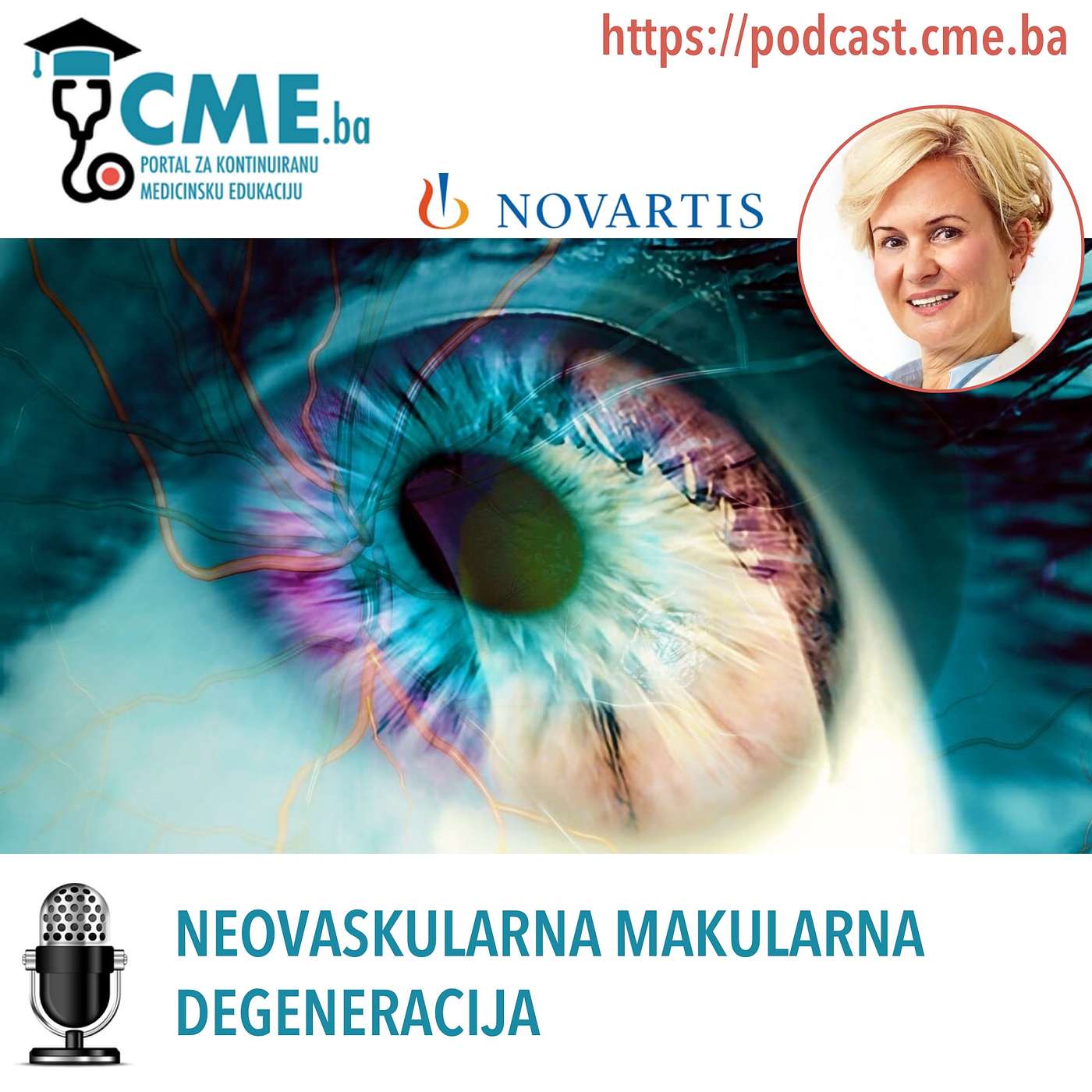Neovaskularna makularna degeneracija